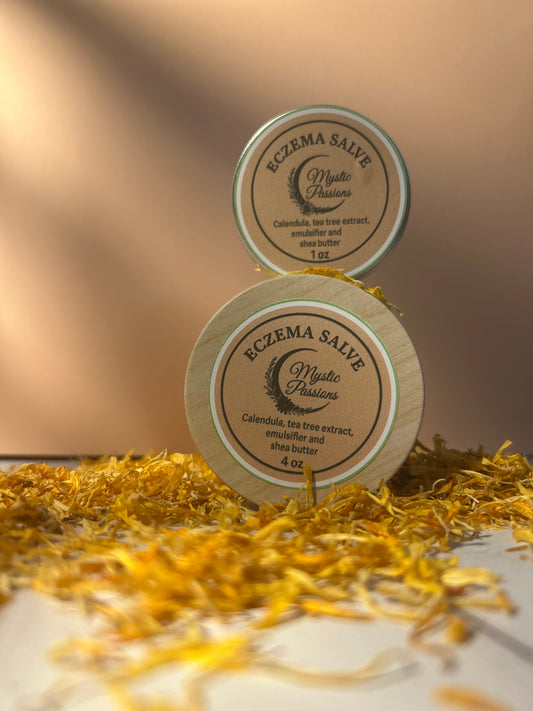 Zoe’s Travel Special – Eczema Relief Salve Duo